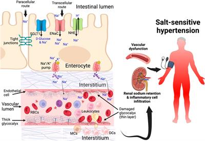 High salt intake and HIV infection on endothelial glycocalyx shedding in salt-sensitive hypertension